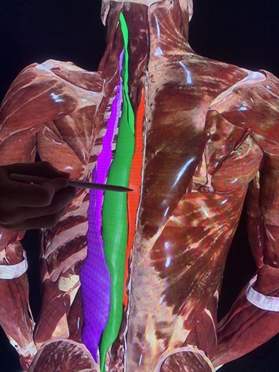 <p>extends and laterally bends the trunk, neck and head</p>