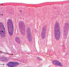 <p>Functions: absorption; secretion of mucus, enzymes, and other substances; ciliated type propels mucus or reproductive cells by ciliary action • Location = Non-ciliated form lines digestive tract, gallbladder, ducts of some glands, ciliated form lines small bronchi, fallopian tubes, and uterus</p>