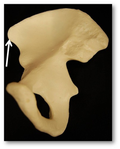 Name this specific part of the pelvic bone.
