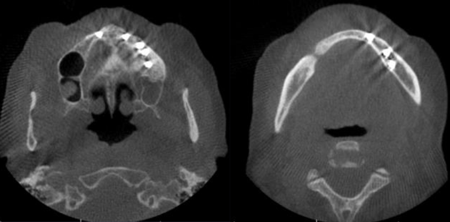 <p>which advanced imaging modality?</p>