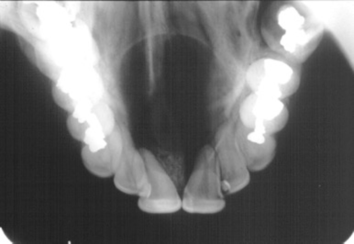 <p>ID the cyst:</p>