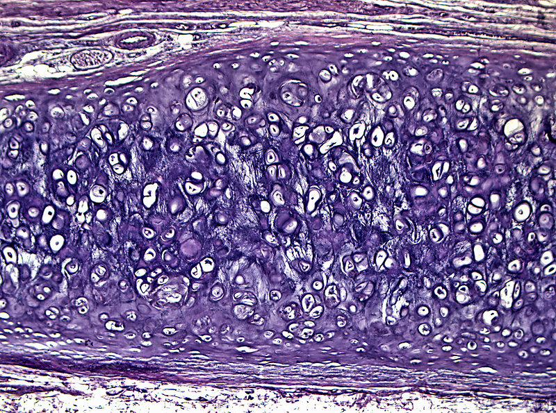 <p>Elastic (Cartilage)</p>