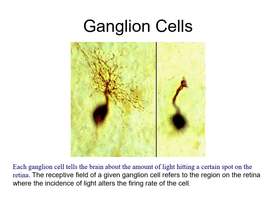 <p><strong><mark data-color="rgba(0, 0, 0, 0)" style="background-color: rgba(0, 0, 0, 0); color: inherit;">final output neurons of the vertebrate retina</mark></strong><span><span>, collecting visual information from bipolar and amacrine cells to transmit it to the brain via the optic nerve.</span></span></p>