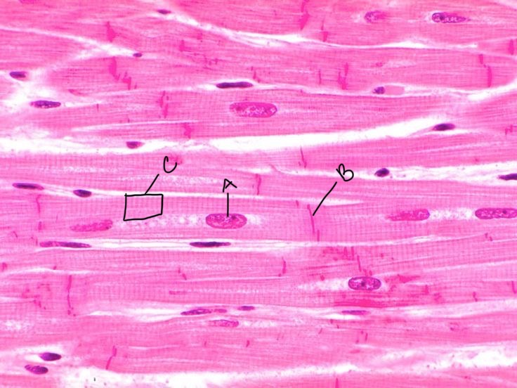 <p>What type of muscle is this?</p>