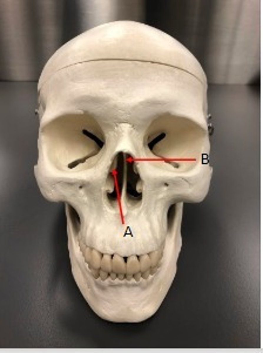 <p>What category of bone is it? What bone is it? Label the structures.</p>