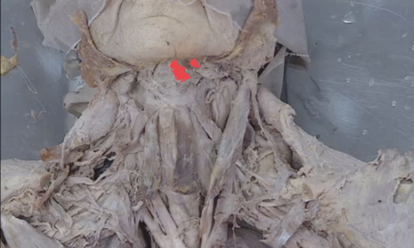 <p>identify this muscle (behind anterior belly of digastric) Duray didn't show it in videos but this is where it will be)</p>