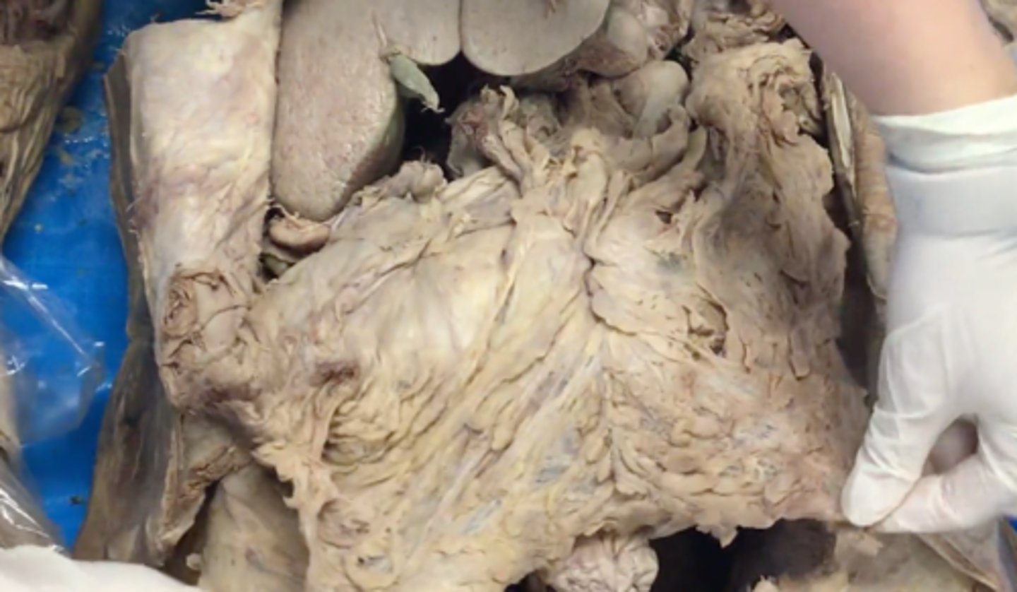 <p>peritoneum connecting greater curvature of stomach and transverse colon</p>