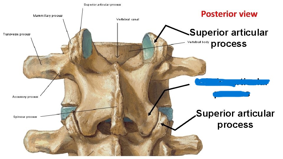 <p>What part of the vertebrae is this?</p>