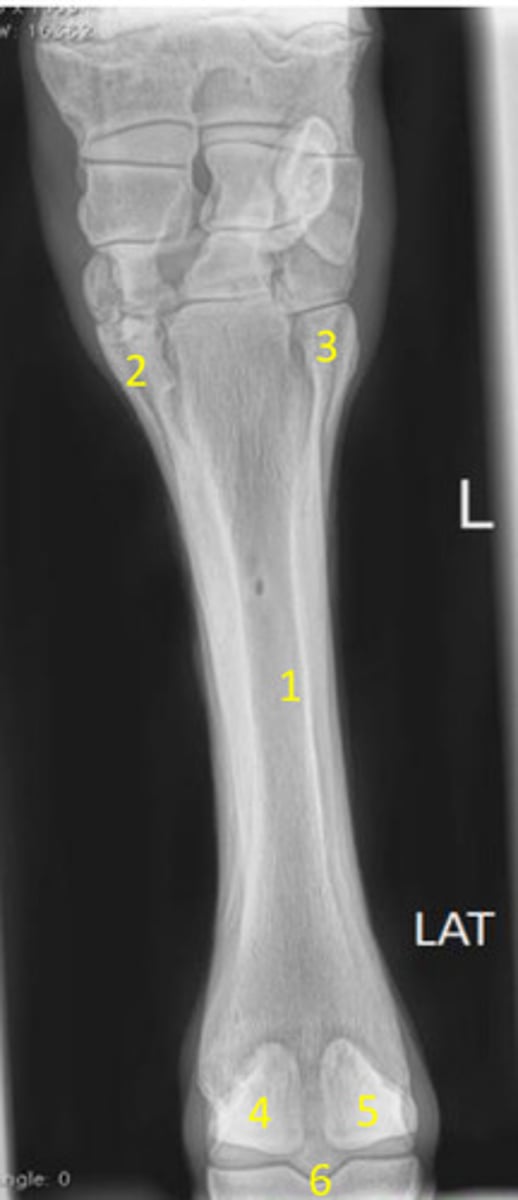 <p>What is 5?</p>