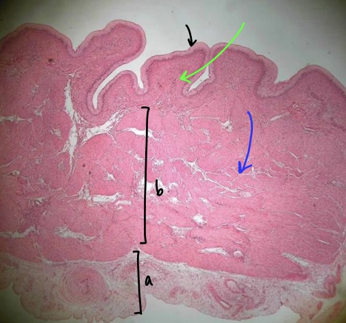 <p>specimen in field of view (&amp; position)</p><p>specific layer at tip of black arrow</p><p>specific tissue at tip of green arrow</p><p>specific layer in bracket b</p><p>specific layer in bracket a</p><p>specific structure at tip of blue arrow</p>