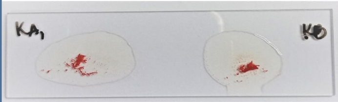<p>Identify the:</p><ul><li><p>Blood Group</p></li><li><p>Antibody/Antibodies Present</p></li><li><p>Antigen(s) Present</p></li></ul><p></p>