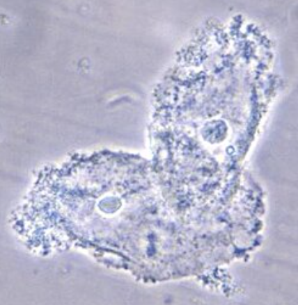 <p>Squamous epithelial cell variation that is indicative of bacterial vaginosis by <span style="color: red;">Gardnerella vaginalis</span></p><ul><li><p>must be <span style="color: red;">70%</span> covered with Gardnerella coccobacillus</p></li></ul><p></p>