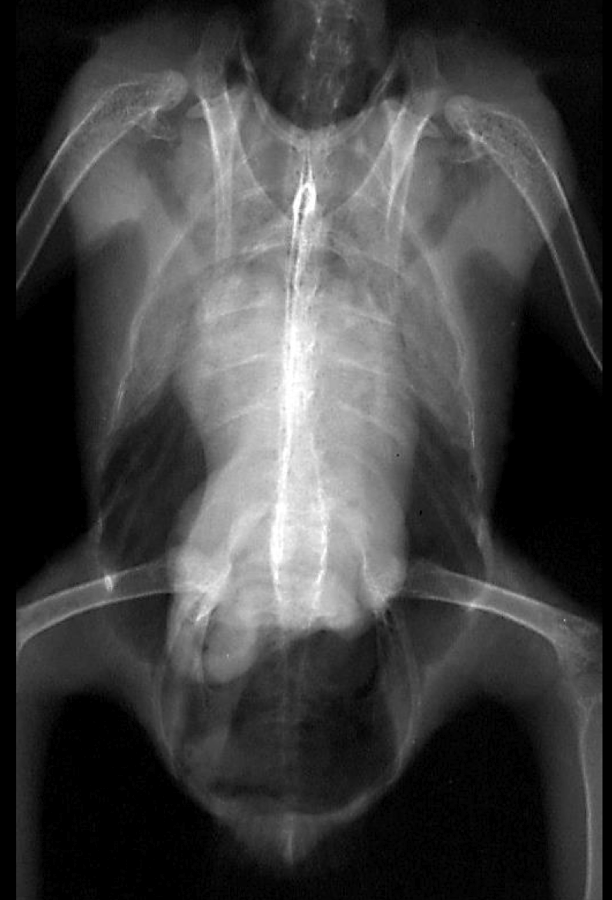 <p>What is a common radiographic lesion of the avian cardiovascular system that presents as fluid accumulation?</p>