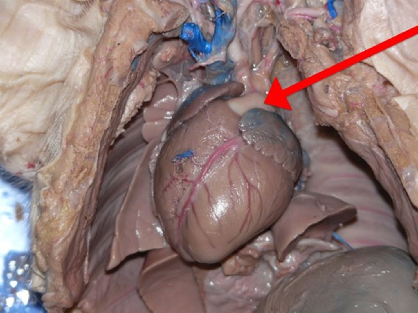 <p>The major artery leading from the right ventricle of the heart to the lungs; it carries oxygen-poor blood.</p>