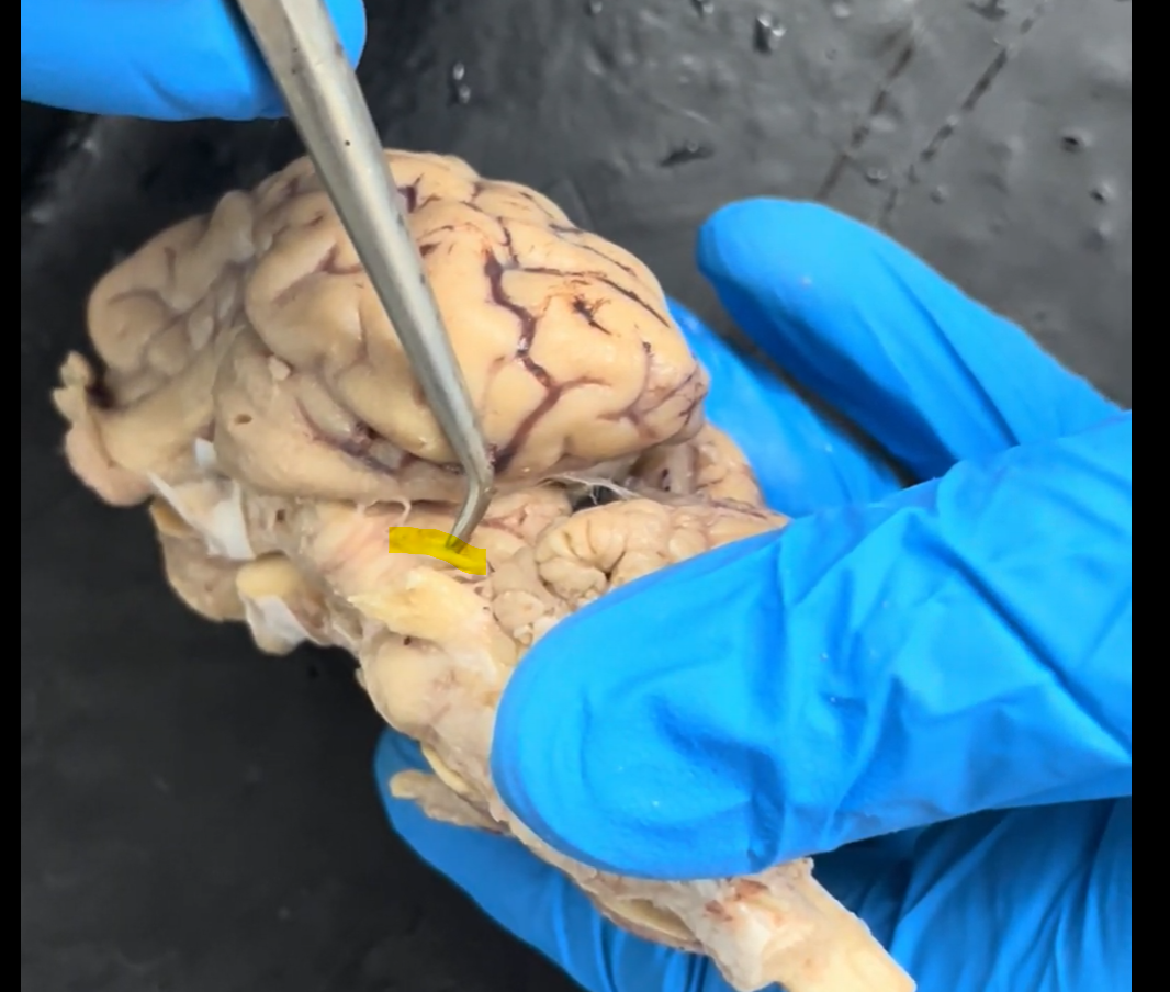 <p>Name the part of the brain being raised by the probe and highlighted in yellow.</p>