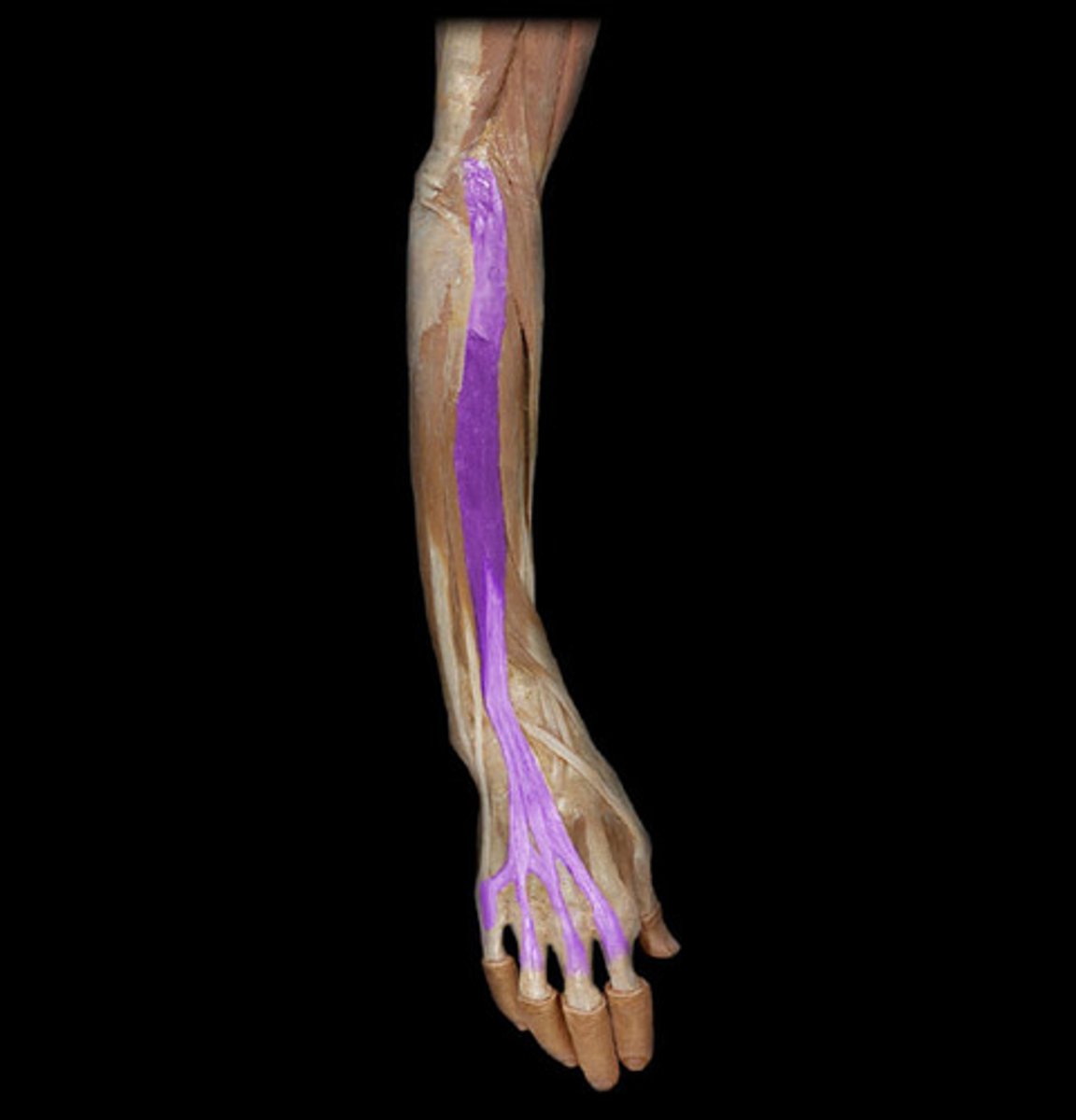 <p>Origin: Lateral epicondyle of humerus</p><p>Insertion: Distal and middle phalanges of fingers 2-5</p><p>Action: Extends hand at the wrist; extends MP joints; extends PIP joints; extends DIP joints of fingers 2-5</p><p>Innervation: Radial nerve (C6-C8 fibers)</p>