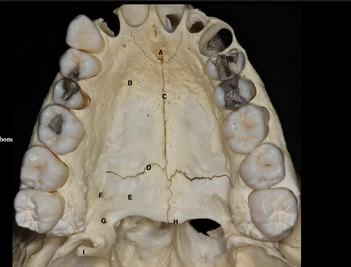 <p>label the parts of the hard palate </p>