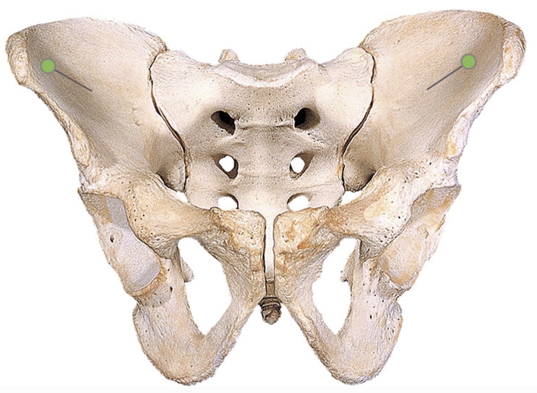 <p>Which bone landmark of the pelvic girdle is a depression on the front?</p>