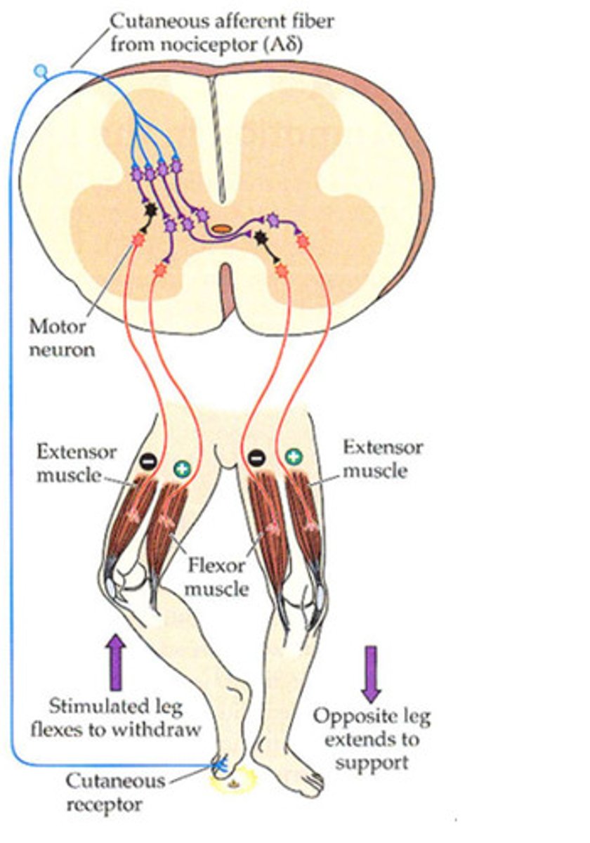 <p>Stimulus: pain (stepping on something sharp)</p><p>Receptor: nociceptors</p><p>Desired Action: pull foot away (flex)</p><p>- # synapses: multisynaptic</p><p>- Ipsi-contra?: ipsilateral</p><p>- effect on alpha motor neuron: excite (stimulate)</p><p>Reciprocal inhibition:</p><p>- # synapses: multisynaptic</p><p>- Ipsi-contra?: ipsilateral</p><p>- effect on alpha motor neuron: relax</p>