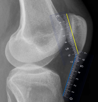 <p>Q what is the name of this measurement? and what is the average + range?</p>