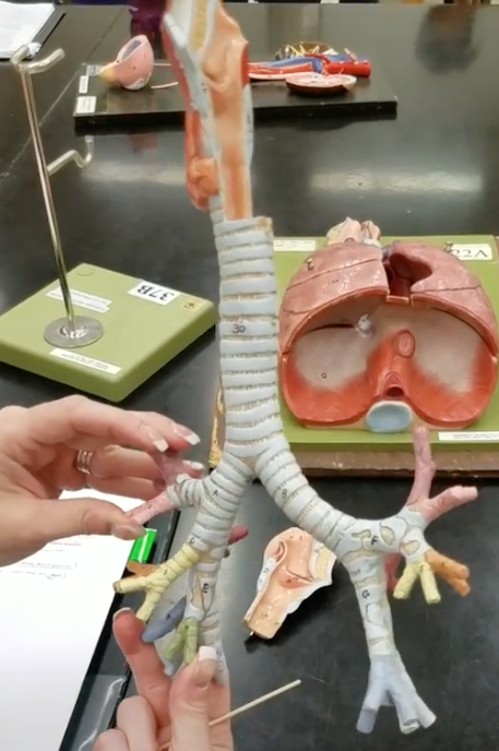 <p>Name of structures being pinched</p>