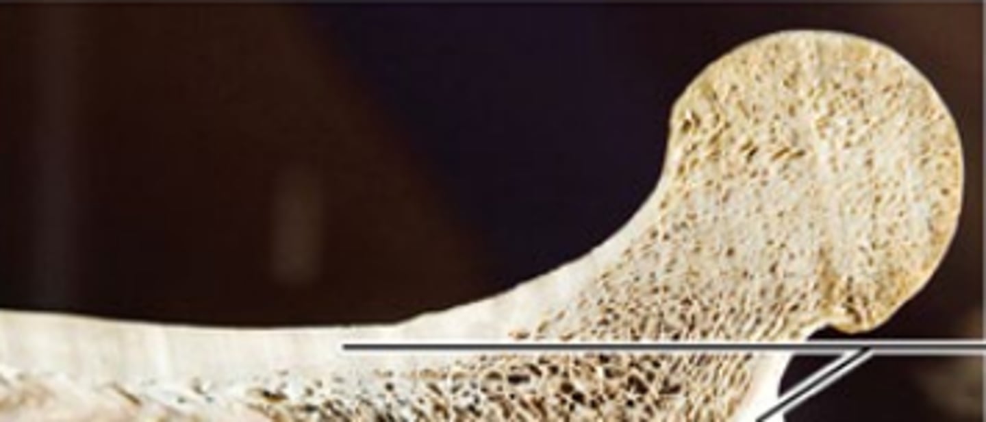 <p>What part of the bone is this?</p>