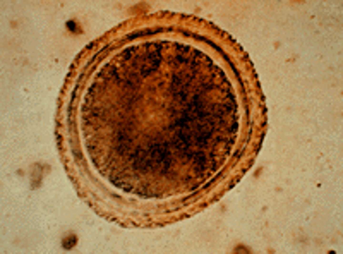 <p>Larvae in biopsy specimens</p><p>Cats and dogs</p>