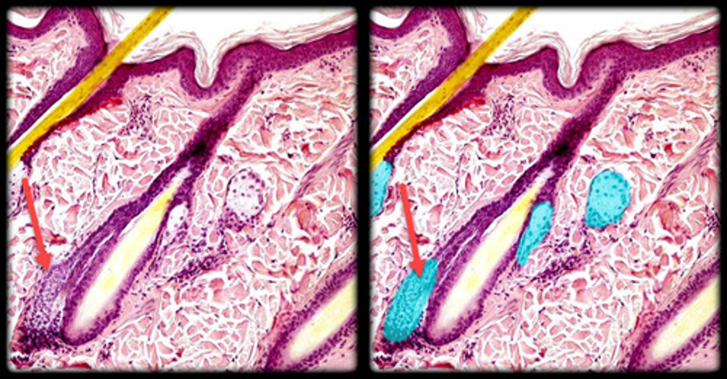 <p>- Associated with hair follicles, producing oily sebum.</p><p>- Appears as clusters of rounded, lobular cells located near hair follicles.</p><p>- Cells may have a bubbly or foamy appearance due to lipid content.</p><p>- Found in the dermis, usually connected to hair follicles, and absent in thick skin (e.g., palms, soles).</p>