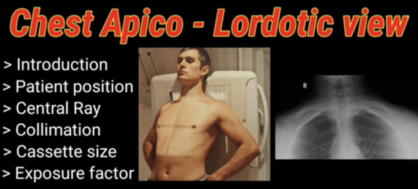 <p>An apical or lordotic view may provide greater detail of the lung apices, as the clavicles can obscure subtle lesions when superimposed over the lungs in standard views.</p><p>This radiographic technique is used to move the clavicles out of the way, reducing overlap with upper parts of lungs in the image. Provides greater detail and visibility of lung apices, allow for detection of subtle lesions or abnormalities that might be obscured by clavicles in standard chest X-ray views.</p>