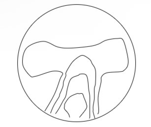 <p>Is this a hard or soft PPL lens design and what plot is it</p>