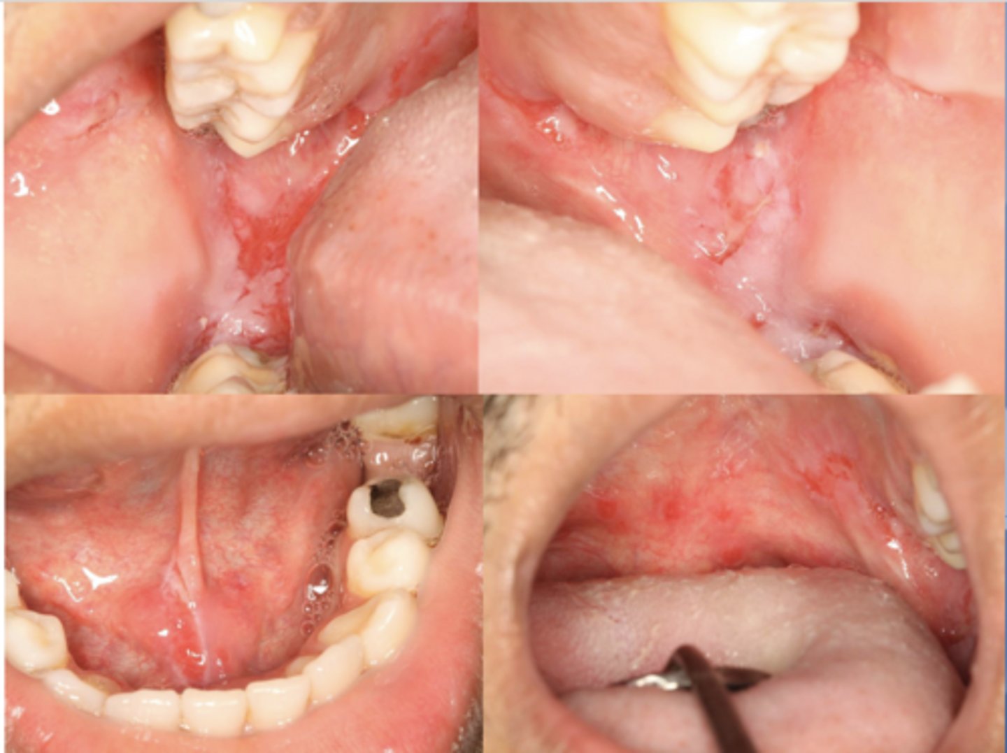 <p>What condition?</p>