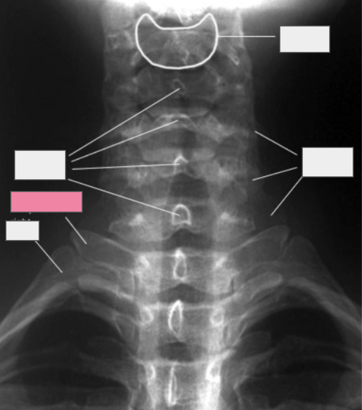 <p>What structure of the spine does the box highlighted in pink reference to?</p>
