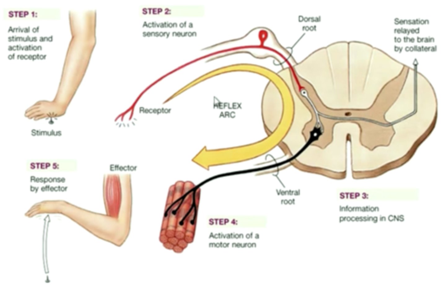 <p>1. Stimulus detected by receptors and converted into a nerve impulse.</p><p>2. The nerve impulse is transmitted along the sensory neuron through the dorsal root to the spinal cord.</p><p>3. The impulse is transmitted from the sensory neuron to an interneuron in the spinal cord.</p><p>4. The impulse is transmitted from the interneuron to a motor neuron in the spinal cord.</p><p>5. The impulse exits the spinal cord through the ventral root and is transmitted along the axon to the effector organs (muscle in arm contracts).</p><p>6. The hand pulls away from the stimulus quickly.</p>