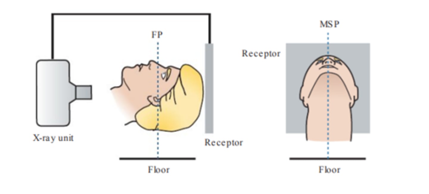 <p>- head tipped back</p><p>- top of head touches receptor</p>