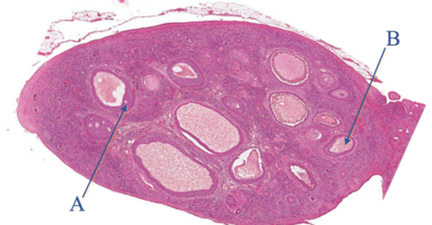 <p>What is the organ being shown</p>