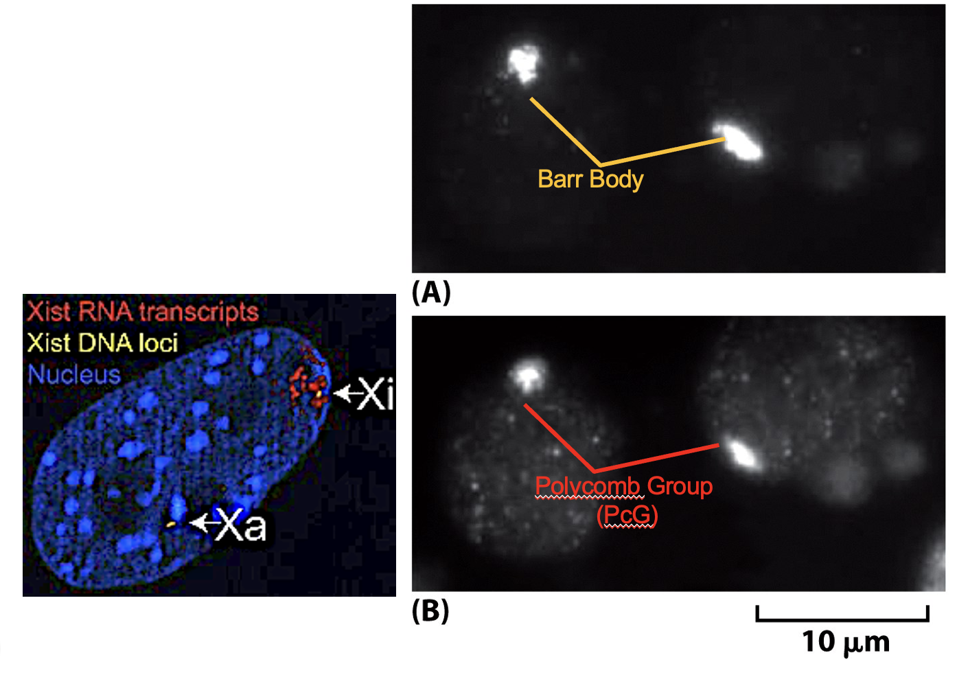 <p>The XIST gene encodes a large XIST RNA. The X-chromosome containing the XIST gene will be inactivated. </p><p>Barr Bodies are inactive X-chromosomes painted with XIST RNA; RNA FISH (fluorescent in situ hybridization test)</p><p>Polycomb (PcG) Antibodies bind to Baar Bodies.</p><p>If there is an active XIST signal, then the baby is a female <span data-name="slightly_smiling_face" data-type="emoji">🙂</span> </p>