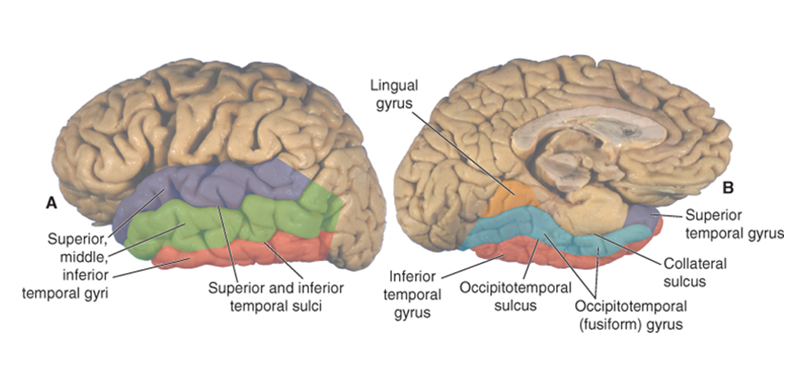 <p>outer view: superior, middle, and inferior temporal gyri and the superior and inferior temporal sulci</p><p>midsagittal view: lingual gyrus, collateral sulcus, occipitotemporal sulcus, occipitotemporal (fusiform gyrus). can see parts of the superior and inferior temporal gyri.</p>