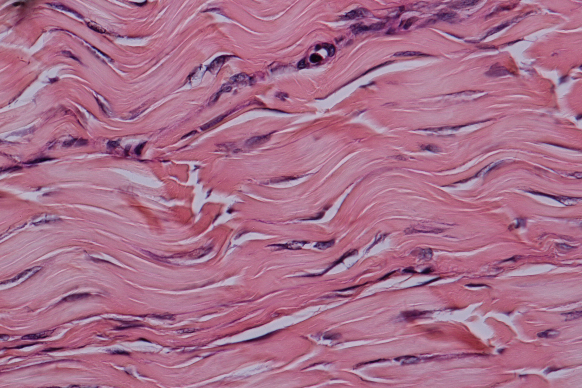 <p>what kind of tissue is this?</p>