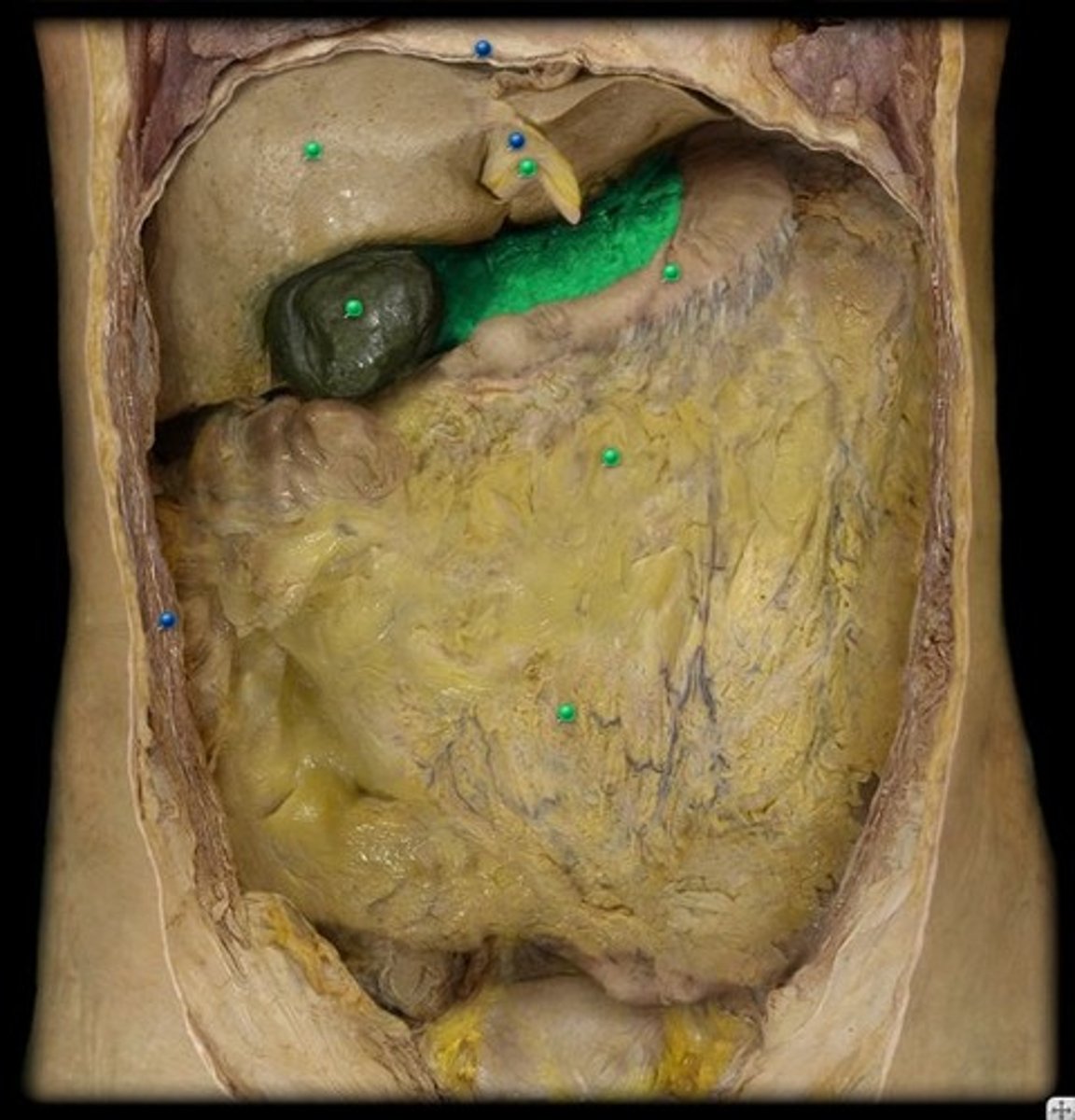 <p>tissue that extends from the liver to the lesser curvature of the stomach</p>