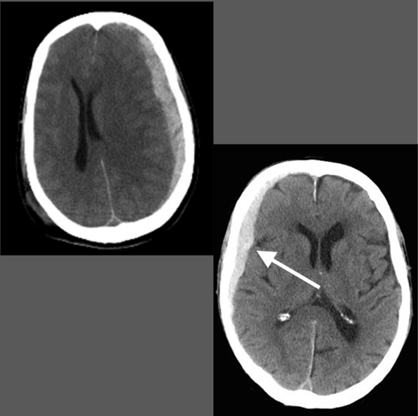 <p>What is this pathology?</p>