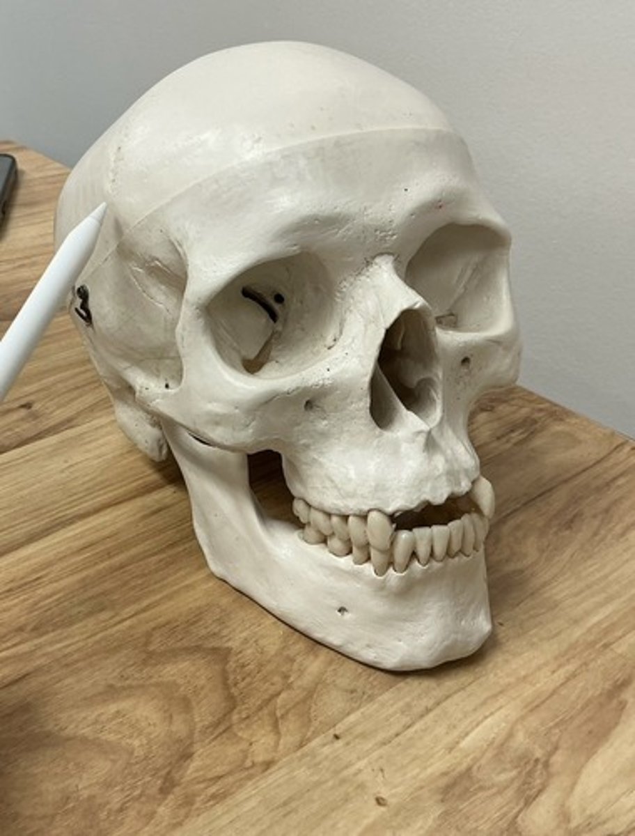 <p>What suture is this?</p>