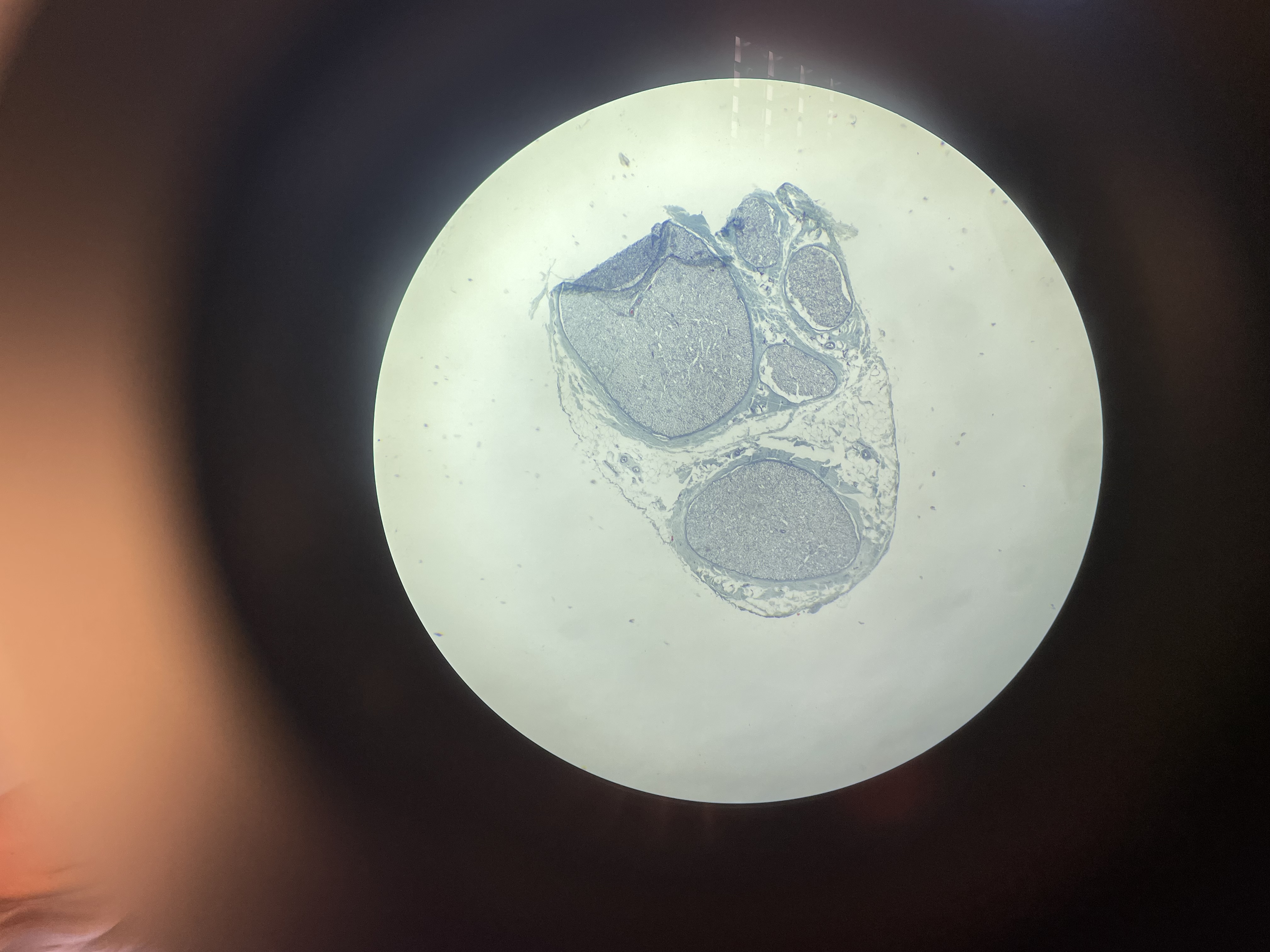 <p>może być niebieskie, różowe, fioletowe </p>