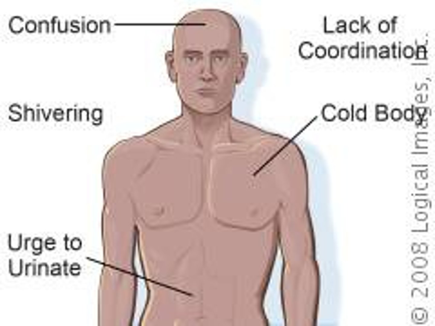 <p>stiff muscles, cold skin; shivering; weakness and dizziness; slow breathing and heart rate`</p>
