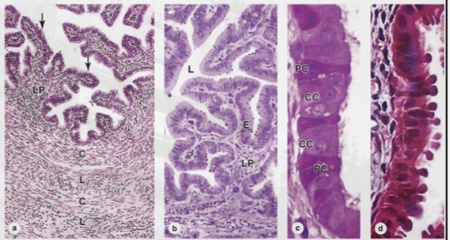 <p><span>The wall consists of:</span></p><p class="p1"><span>• Folded mucosa with</span></p><p class="p1"><span>ciliated and secretory</span></p><p class="p1"><span>cells</span></p><p class="p1"><span>• Smooth muscle layer</span></p><p class="p1"><span>for peristalsis</span></p><p class="p1"><span>• Outer serosa</span></p>