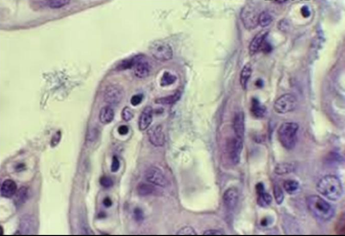 <p>Which species of flavobacterium causes bacterial gill disease, makes a toxin, does not invade the gills themselves, and causes acute vasoconstriction? This leads to hypoxia/hyperplasia, is often seen after a stress event, and is treated with immersion in formalin or another medicine, often with instant recovery.</p>