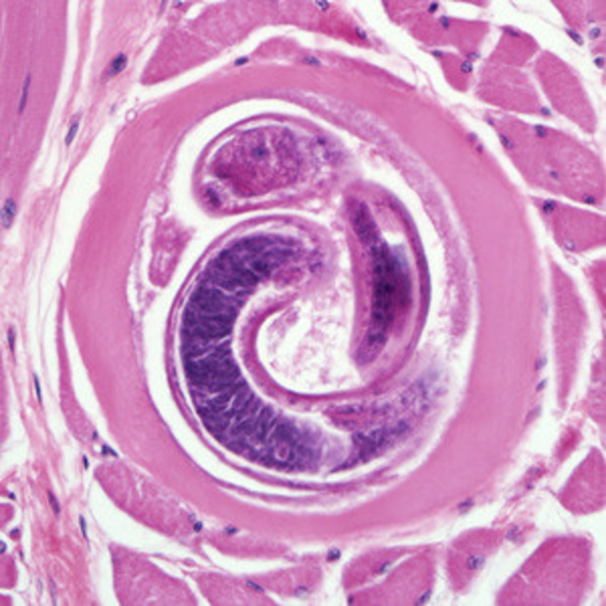 <p>larva in muscle</p>