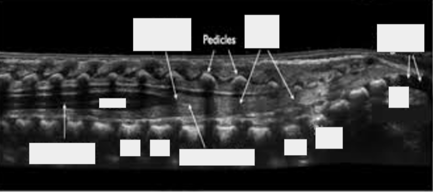 <p>Coccygeal segments (coccyx), cord, T12, Conus medullaris, Filume terminale, L1, L5, S5, S1, Pedicles, Nerve roots (cauda equina), Central canal (central echo complex)</p>
