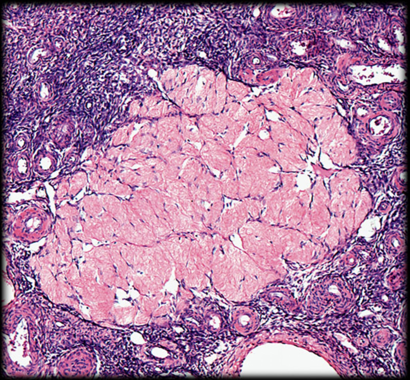 <p>What structure is shown (middle structure)?</p>