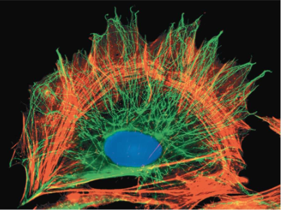 <p>Network of fibers inside cystoplasm</p><p></p><ul><li><p>Organizes the cell’s structures and activities, anchoring many organelles</p></li></ul><p></p><p>plays a role in:</p><ol><li><p>shape</p></li><li><p>cell motility</p></li><li><p>regulation of biochemical activities</p></li></ol><p></p><p></p>
