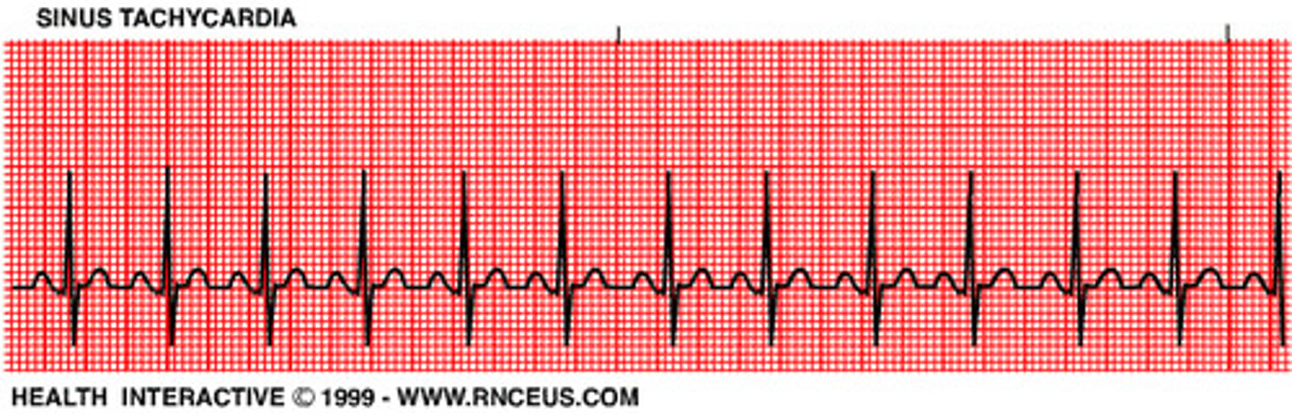 <p>Fast heart rate; &gt;100bmp</p>